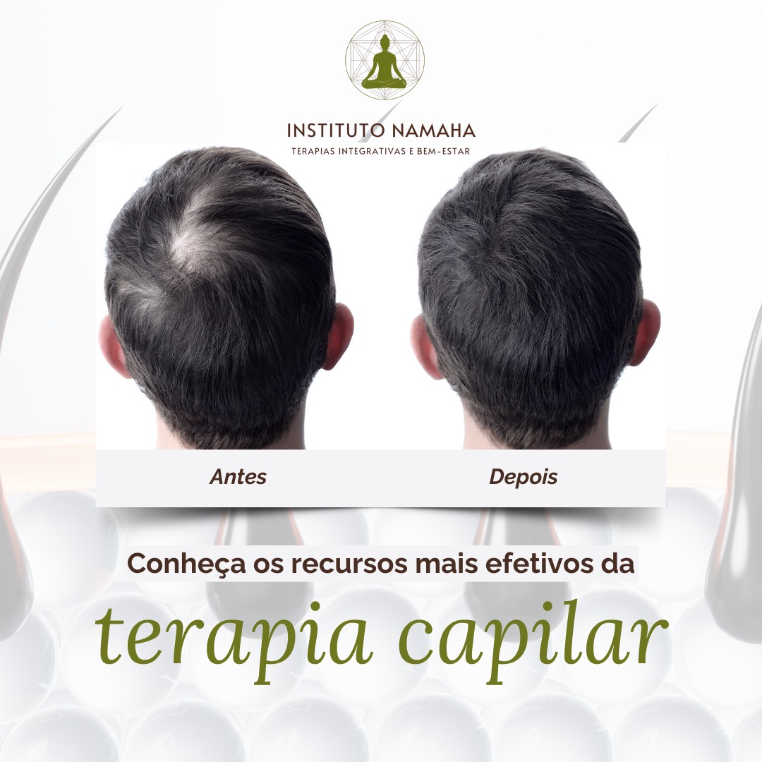 Terapia Capilar